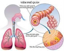 05 biện pháp phòng, chống các bệnh lây truyền qua đường hô hấp